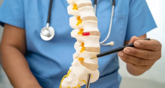 Ameliyatsız Bel Fıtığı Tedavisi