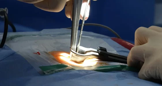 Mikrocerrahi ile Bel ve Boyun Fıtığı Ameliyatları