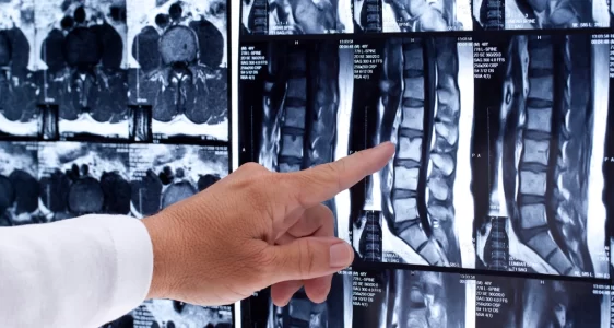 Omurga Travmaları (Servikal, Torakal, Lomber, Sakral)