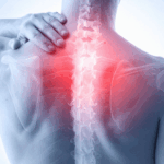 Omurga Dar Kanal Nedir, Hangi Belirtilerle Ortaya Çıkar?